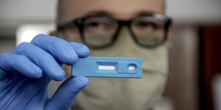 La Anmat autorizó el uso de cuatro test de autoevaluación de Covid-19