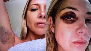 La denuncia de Fabiola Yañez contra Alberto Fernández