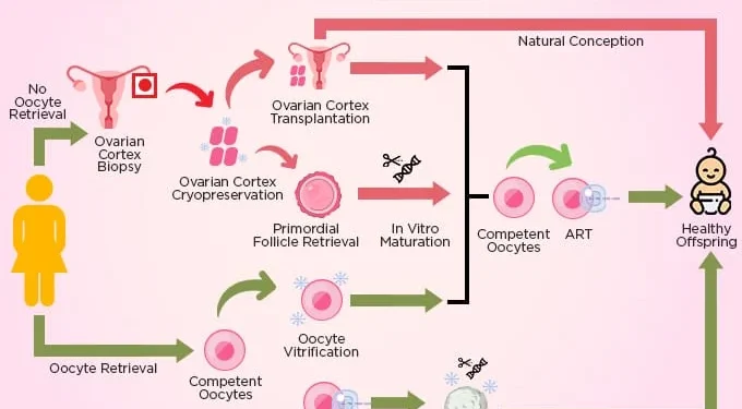 Oncofertilidad: un enfoque clave en los tratamientos oncológicos